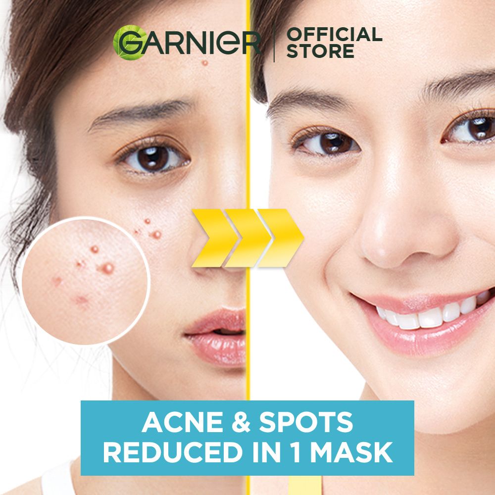 GARNIER ANTI ACNE MASK