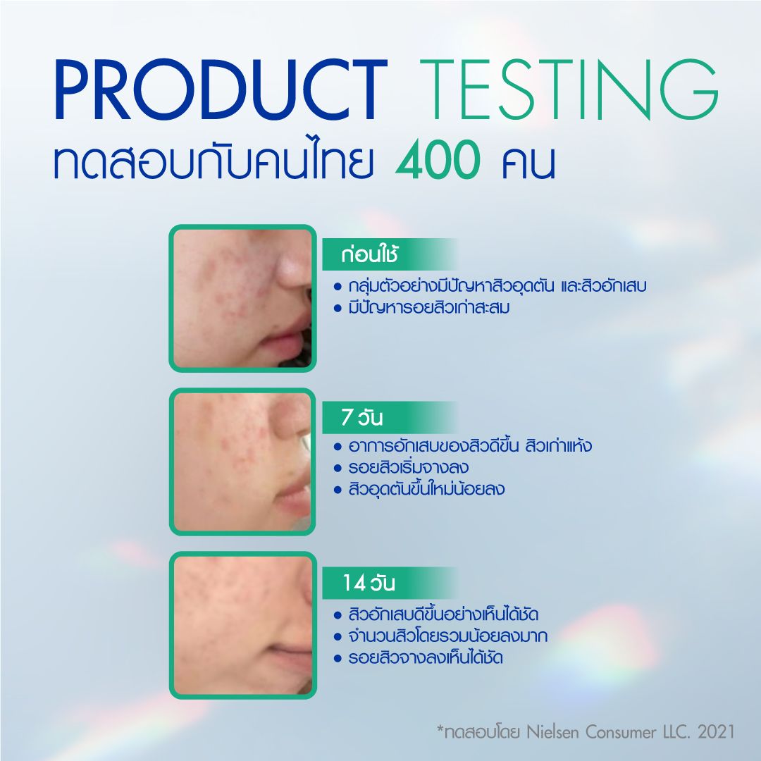 นีเวีย แอคเน่ ไมโคร เคลนเซอร์ 90มล