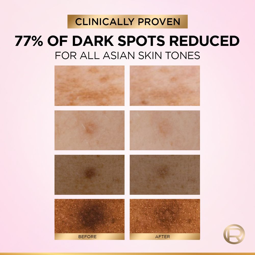 ลอรีอัลไกลโคลิคเซรั่ม 30 มล.