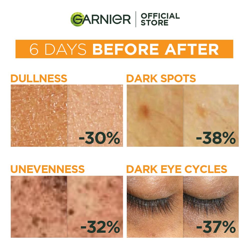 การ์นิเย่วิตามินซีแอมพูลเซรั่ม 1.5มลX12