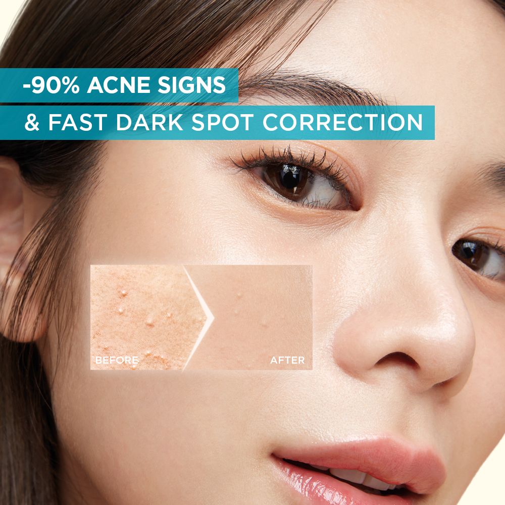 GARNIER BRIGHT COMPLETE ANTI ACNE SERUM 7.5ML