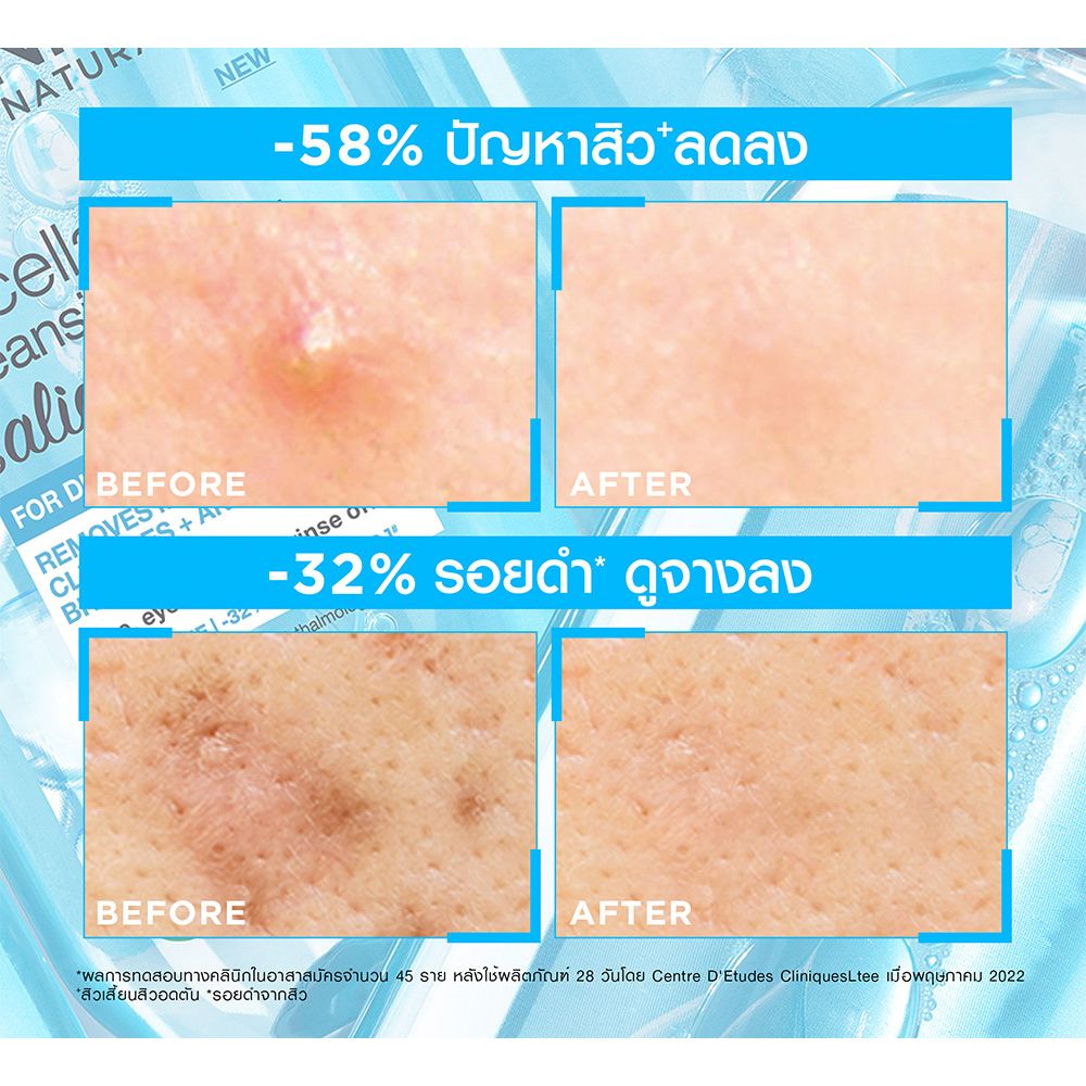 การ์นิเย่ ไมเซล่า ซาลิไซลิค บีเอชเอ400มล