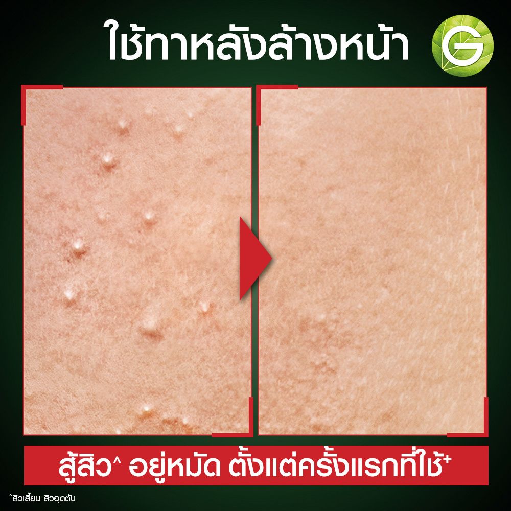 GARNIER MEN ACNOFIGHT SUPER SERUM 7ML