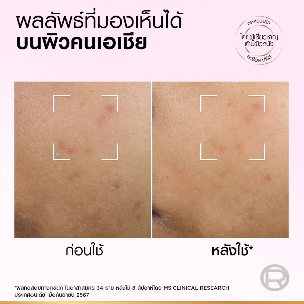 LOREAL GLYCOLIC EXFOLIANT PEEL 25 ML.